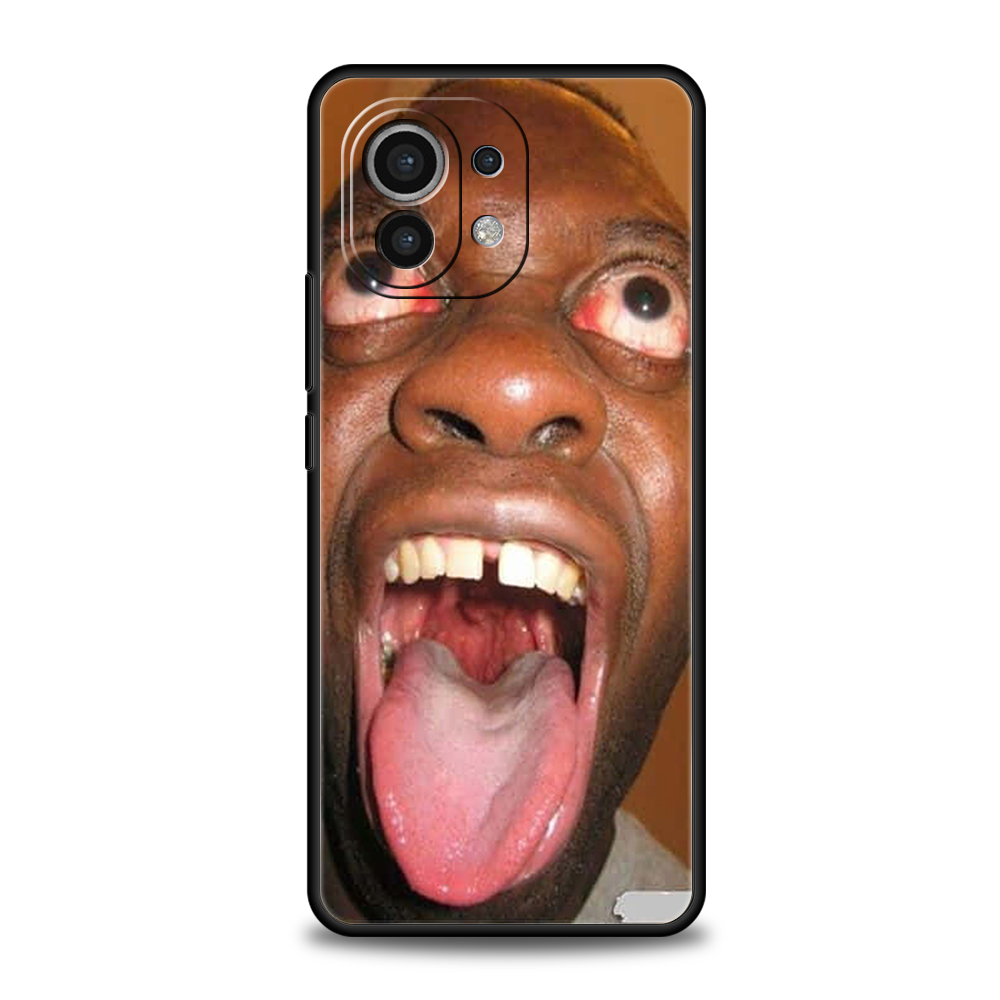 غطاء حماية للهاتف لشاومي بوكو  - مراجعة Phone Cases Ugly وسعره
